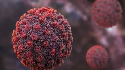 Parkinson's Disease New Study Flags Viral Infection