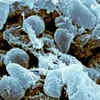 Irkutsk Plague Lab Death Prompts New WHO Review